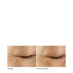 Dr Dennis Gross Advanced Retinol + Ferulic Triple Correction Eye Serum - Image 4