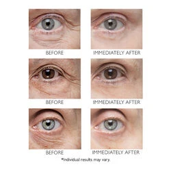 Peter Thomas Roth Instant FirmX Eye 2 Peter Thomas Roth Instant FirmX Eye - Image 2